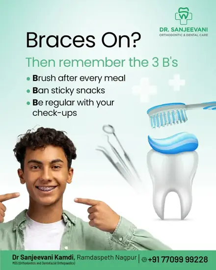 Dr. Sanjeevani Orthodontic & Dental Care Occasion and care tips: Braces on? Remember the 3 B's